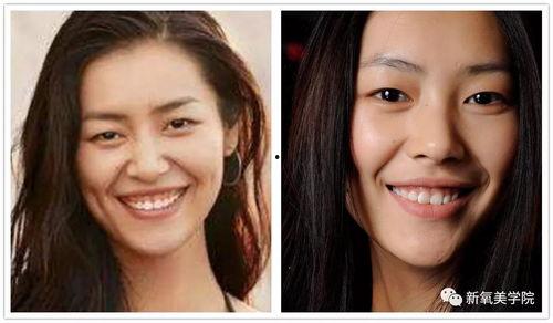 明星龈笑,揭秘明星们的自信笑容秘诀